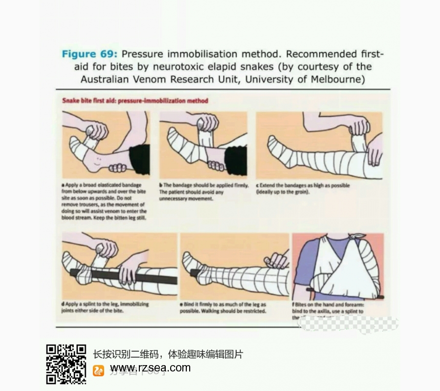 被蛇咬了怎么办？